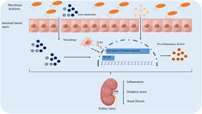 The role and mechanism of gut microbiota-derived short-chain fatty in the prevention and treatment of diabetic kidney disease